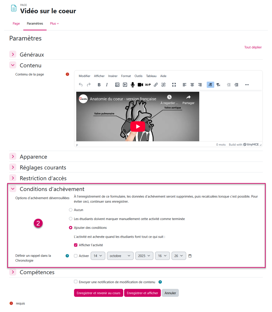 Image de paramètre d'une activité dans Moodle. Spécifiquement les conditions d'achèvement. 